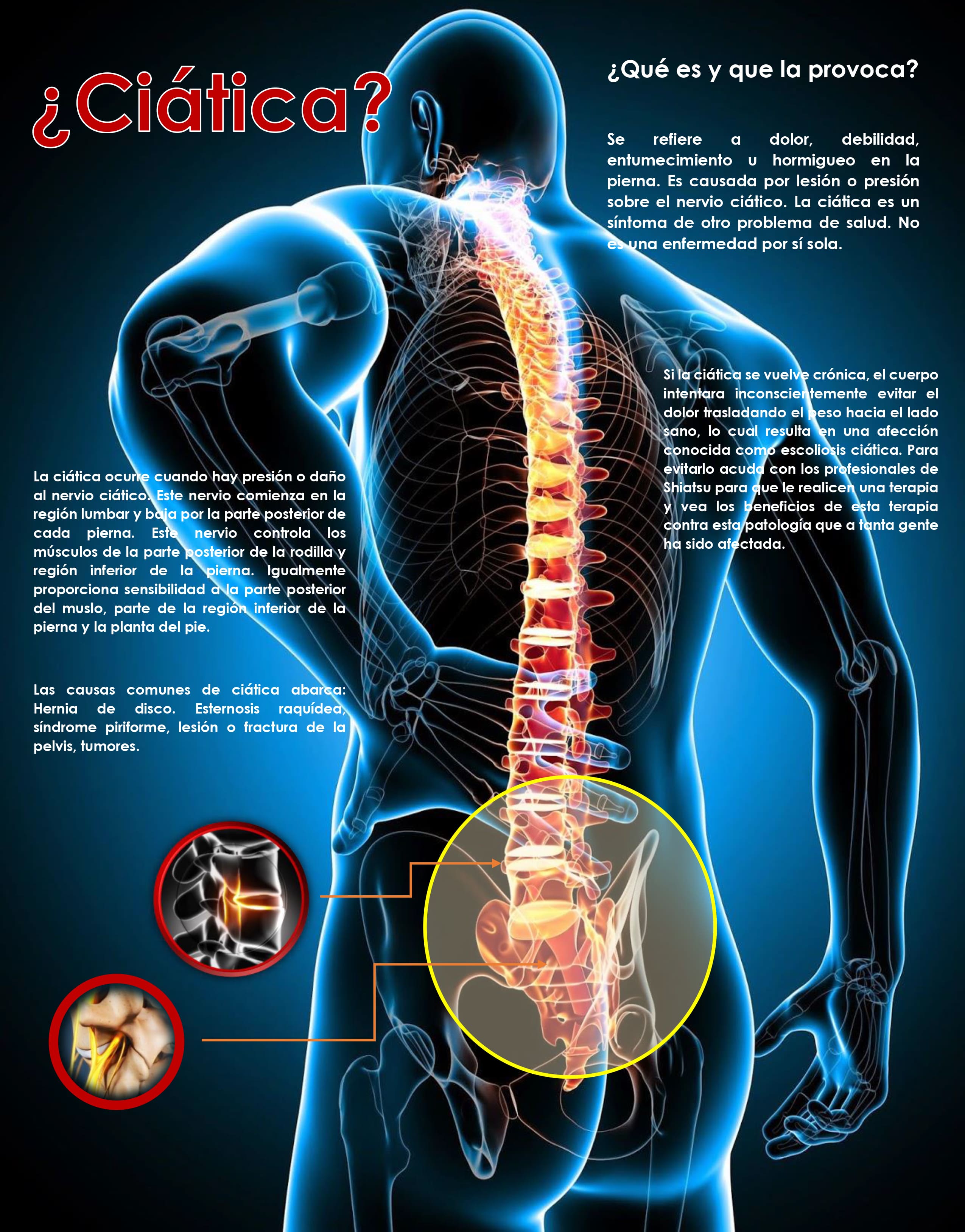 ¿Sufres de Dolor de Ciatica?